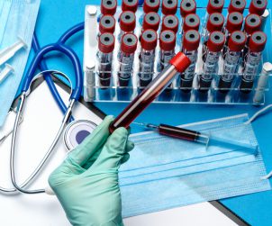 Analityk laboratoryjny trzyma w dłoni fiolkę z krwią pacjenta, w tle położone są różne akcesoria medyczne. /Źródło: 123rf.com