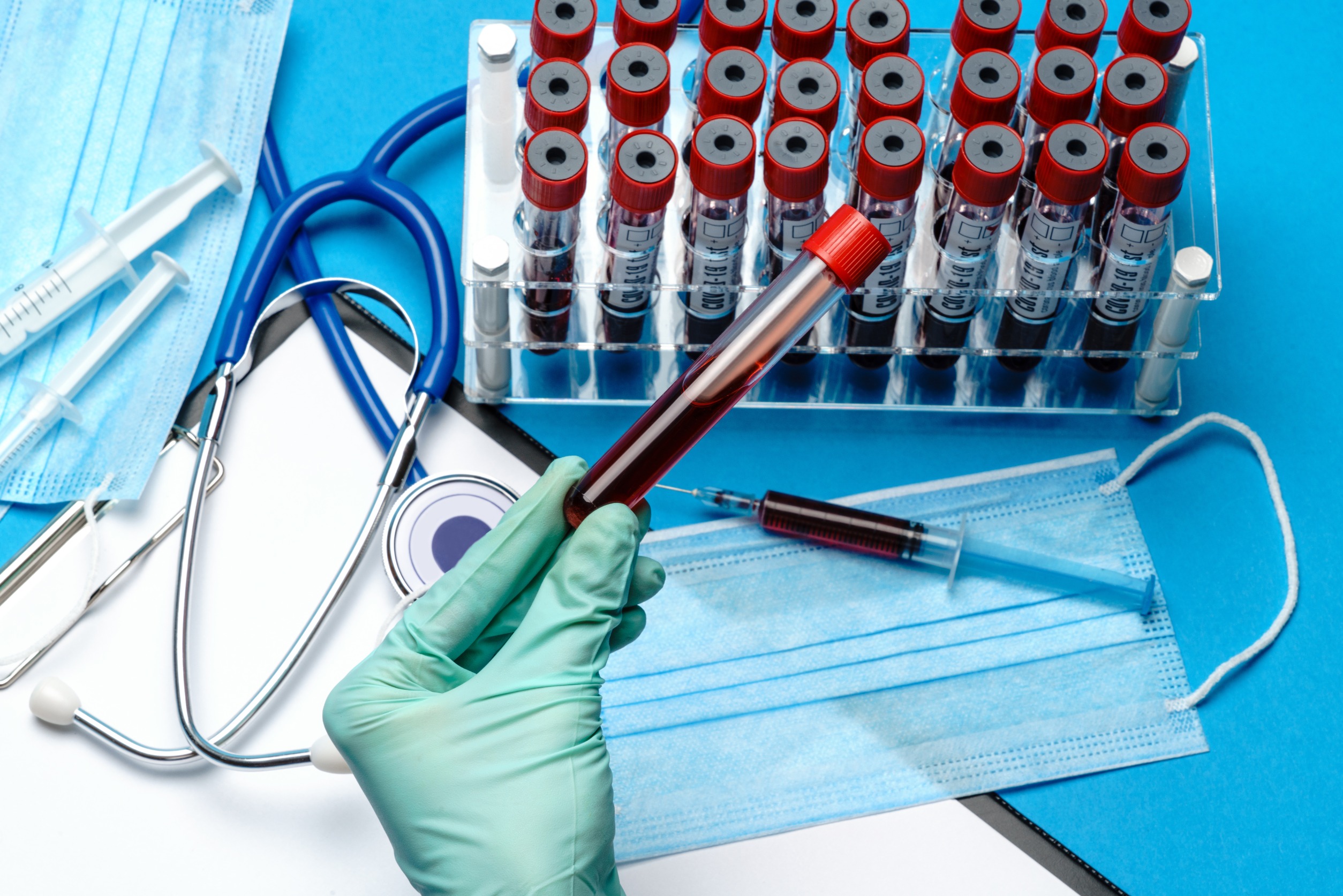 Analityk laboratoryjny trzyma w dłoni fiolkę z krwią pacjenta, w tle położone są różne akcesoria medyczne. /Źródło: 123rf.com