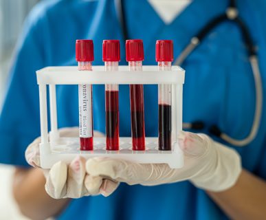 Pielęgniarka w niebieskim, medycznym stroju ze stetoskopem na szyi trzyma w dłoni cztery probówki z krwią pobraną do badań laboratoryjnych. /Źródło: 123rf.com