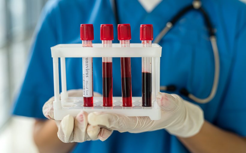 Pielęgniarka w niebieskim, medycznym stroju ze stetoskopem na szyi trzyma w dłoni cztery probówki z krwią pobraną do badań laboratoryjnych. /Źródło: 123rf.com