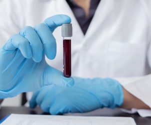 Analityk medyczny trzyma w dłoni probówkę wypełnioną próbką krwi w celu poddanie jej badaniom laboratoryjnym. /Źródło: 123rf.com