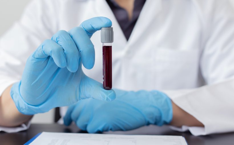 Analityk medyczny trzyma w dłoni probówkę wypełnioną próbką krwi w celu poddanie jej badaniom laboratoryjnym. /Źródło: 123rf.com