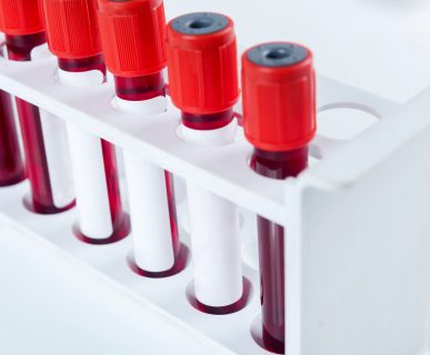 Probówki wypełnione krwią równo ułożone w białym organizerze. /Źródło: 123rf.com
