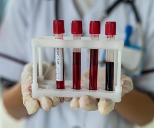 Pielęgniarka w białym stroju medycznym trzyma w dłoniach odzianych w sterylne rękawiczki, probówki wypełnione krwią pacjentów. /Źródło: 123rf.com