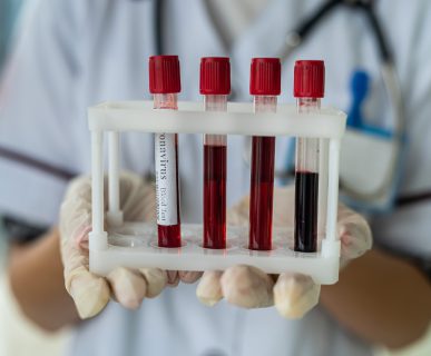Pielęgniarka w białym stroju medycznym trzyma w dłoniach odzianych w sterylne rękawiczki, probówki wypełnione krwią pacjentów. /Źródło: 123rf.com