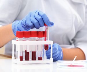 Technik laboratoryjny odkłada probówkę z próbką krwi po analizie i diagnostyce. /Źródło: 123rf.com