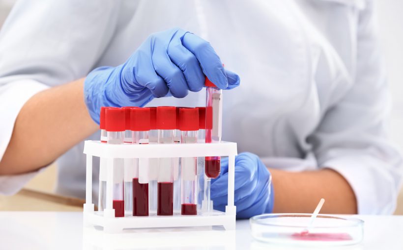Technik laboratoryjny odkłada probówkę z próbką krwi po analizie i diagnostyce. /Źródło: 123rf.com
