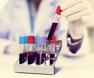 Analityk medyczny odkłada probówkę z krwią pacjenta po przeprowadzonej diagnostyce. /Źródło: 123rf.com