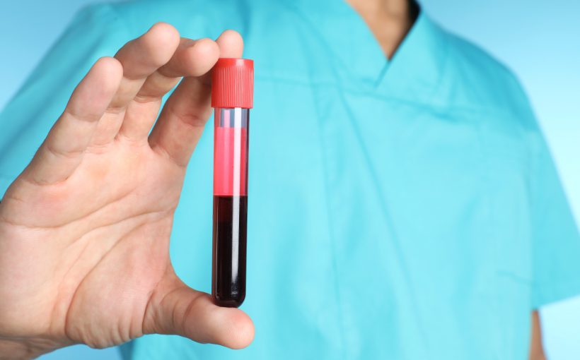 Pielęgniarz w sterylnym stroju medycznym trzyma w dłoni probówkę wypełnioną do połowy krwią pacjenta. /Źródło: 123rf.com