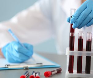 Technik medyczny w laboratorium opisuje dostarczone probówki z pobraną krwią pacjentów w celu dalszej analizy i diagnostyki. Źródło: 123rf.com