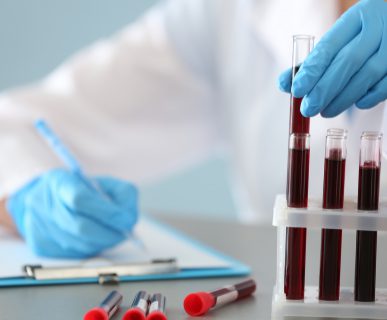 Technik medyczny w laboratorium opisuje dostarczone probówki z pobraną krwią pacjentów w celu dalszej analizy i diagnostyki. Źródło: 123rf.com
