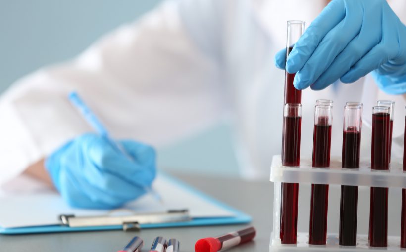 Technik medyczny w laboratorium opisuje dostarczone probówki z pobraną krwią pacjentów w celu dalszej analizy i diagnostyki. Źródło: 123rf.com
