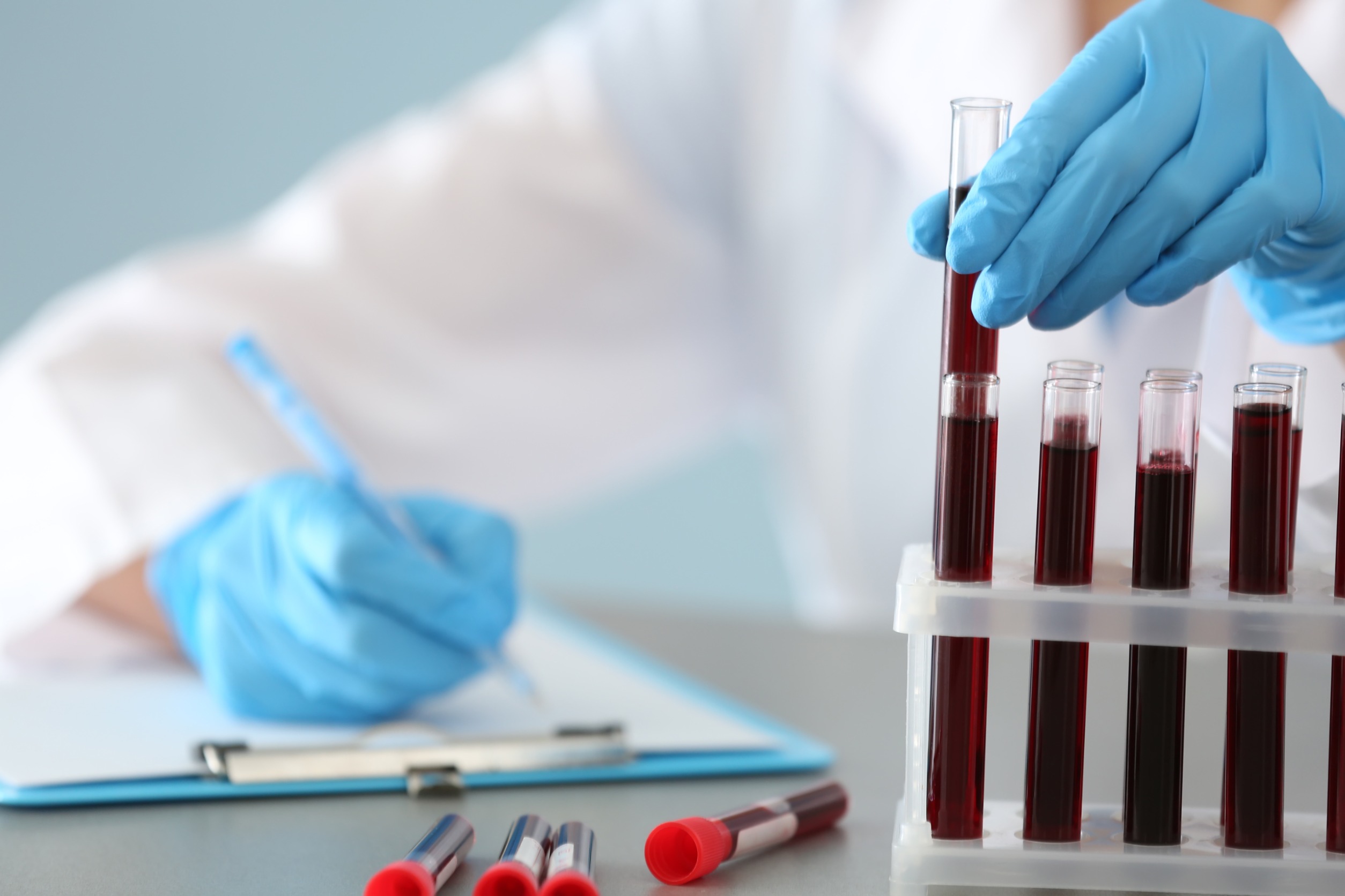 Technik medyczny w laboratorium opisuje dostarczone probówki z pobraną krwią pacjentów w celu dalszej analizy i diagnostyki. Źródło: 123rf.com