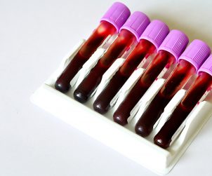 Sześć probówek wypełnionych krwią, z fioletowymi nakrętkami. /Źródło: 123rf.com