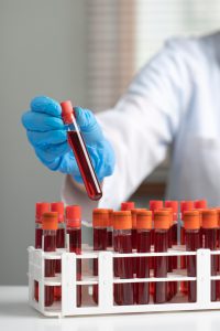 Analityk laboratoryjny wyciąga z organizera probówkę z krwią, aby zbadać jej właściwości. /Źródło: 123rf.com
