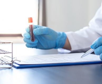 Technik laboratoryjny analizuje próbkę krwi w celu diagnostyki ewentualnych schorzeń. /Źródło: 123rf.com