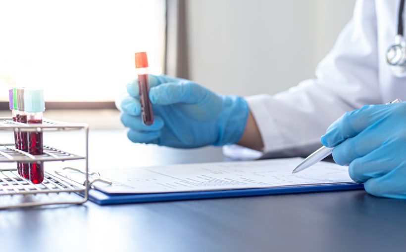Technik laboratoryjny analizuje próbkę krwi w celu diagnostyki ewentualnych schorzeń. /Źródło: 123rf.com