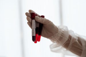 Analityk laboratoryjny trzyma w dłoni fiolki wypełnione próbką krwi. /Źródło: 123rf.com