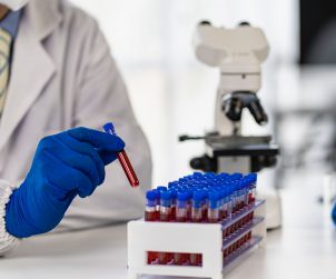 Technik laboratoryjny odkłada probówkę z krwią po poddaniu jej analizie i określeniu wyniku. /Źródło: 123rf.com