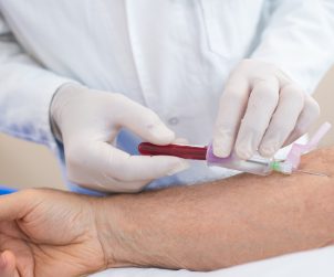 Pielęgniarz pobiera mężczyźnie krew w żyły u ręki aby poddać ją diagnostyce i ewentualnemu leczeniu przez lekarza. /Źródło: 123rf.com