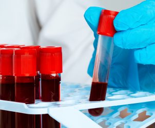 Diagnosta laboratoryjny odkłada do organizera probówkę z krwią pacjenta. /Źródło: 123rf.com