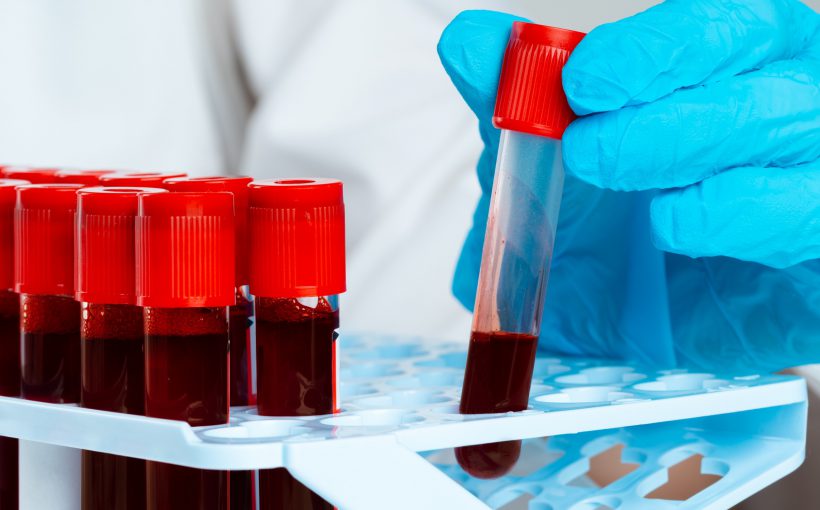 Diagnosta laboratoryjny odkłada do organizera probówkę z krwią pacjenta. /Źródło: 123rf.com