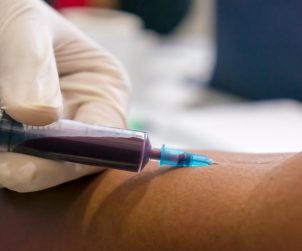Pielęgniarka pobiera pacjentowi krew z żyły u ręki aby przekazać próbkę na badania laboratoryjne. /Źródło: 123rf.com