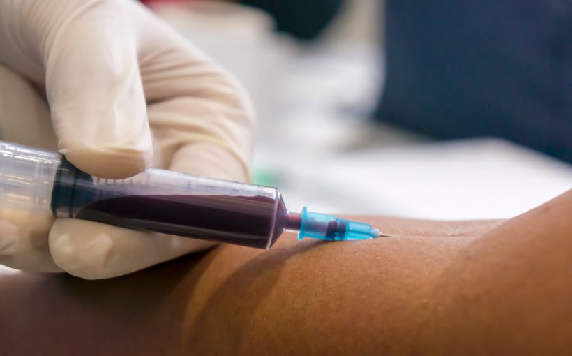 Pielęgniarka pobiera pacjentowi krew z żyły u ręki aby przekazać próbkę na badania laboratoryjne. /Źródło: 123rf.com