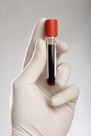 poznań badania krwi, cennik laboratorium