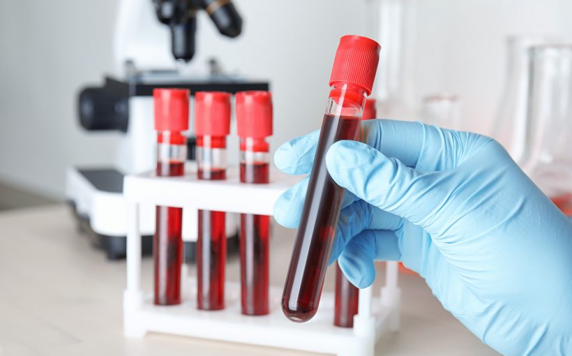 Analityk laboratoryjny trzyma w dłoni probówkę wypełnioną krwią, przeznaczona do badań laboratoryjnych. /Źródło: 123rf.com