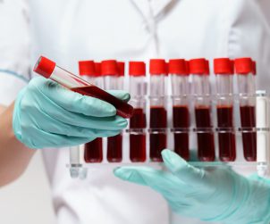 Pielęgniarka trzyma w dłoniach odzianych w sterylne rękawiczki, probówki wypełnione krwią pacjenta. /Źródło: 123rf.com