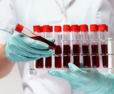 Pielęgniarka trzyma w dłoniach odzianych w sterylne rękawiczki, probówki wypełnione krwią pacjenta. /Źródło: 123rf.com