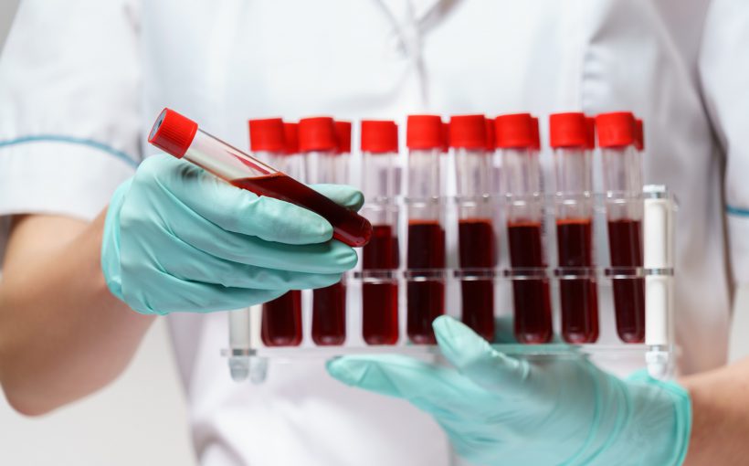 Pielęgniarka trzyma w dłoniach odzianych w sterylne rękawiczki, probówki wypełnione krwią pacjenta. /Źródło: 123rf.com