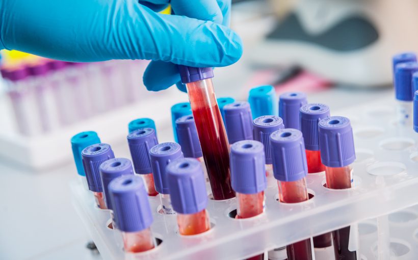 Technik laboratoryjny wyciąga z organizera fiolkę z krwią w celu jej analizy i diagnostyki. /Źródło: 123rf.com
