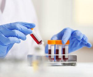 Technik laboratoryjny układa w metalowym organizerze fiolki wypełnione krwią pacjentów. /Źródło: 123rf.com