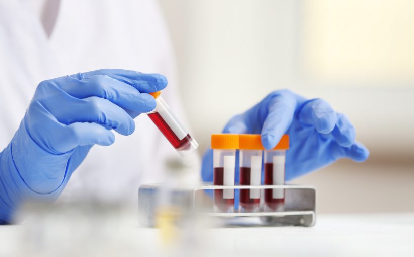 Technik laboratoryjny układa w metalowym organizerze fiolki wypełnione krwią pacjentów. /Źródło: 123rf.com