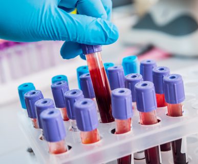 Analityk laboratoryjny odkłada probówkę z krwią po dokonanej diagnostyce. /Źródło: 123rf.com