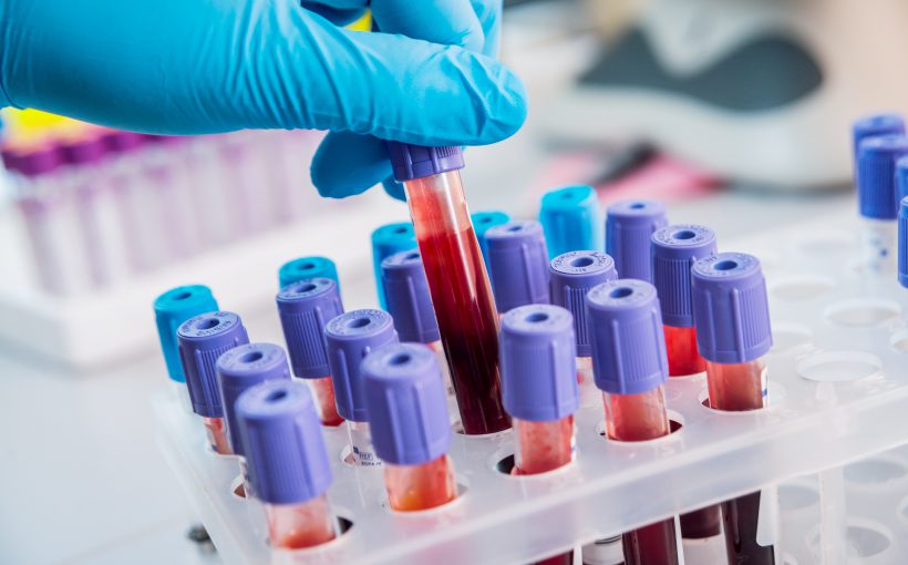 Analityk laboratoryjny odkłada probówkę z krwią po dokonanej diagnostyce. /Źródło: 123rf.com