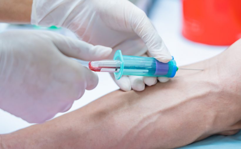 Pielęgniarka pobiera pacjentowi krew z żyły u ręki. /Źródło: 123rf.com
