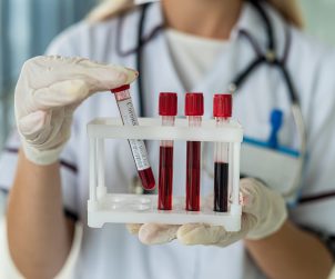 Pielęgniarka trzyma w dłoniach probówki z krwią pacjenta. /Źródło: 123rf.com