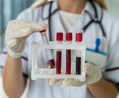 Pielęgniarka trzyma w dłoniach probówki z krwią pacjenta. /Źródło: 123rf.com