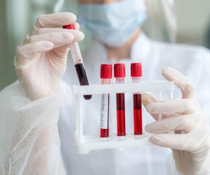 Analityk laboratoryjny trzyma w dłoniach organizer z probówkami z krwią. /Źródło: 123rf.com