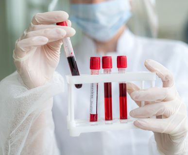 Analityk laboratoryjny trzyma w dłoniach organizer z probówkami z krwią. /Źródło: 123rf.com