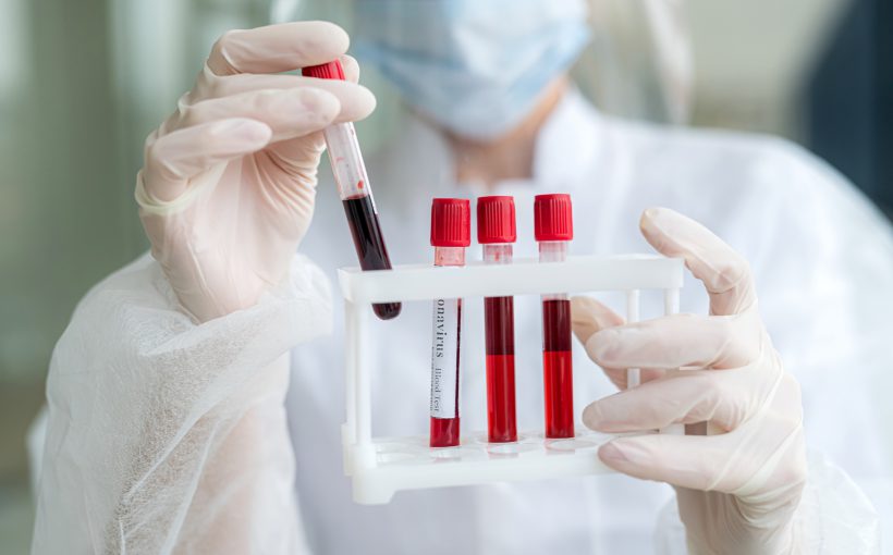 Analityk laboratoryjny trzyma w dłoniach organizer z probówkami z krwią. /Źródło: 123rf.com