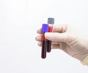Pielęgniarka trzyma w dłoniach odzianych w sterylne, jednorazowe rękawiczki, dwie fiolki wypełnione krwią. /Źródło: 123rf.com