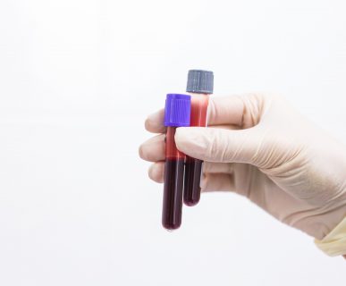 Pielęgniarka trzyma w dłoniach odzianych w sterylne, jednorazowe rękawiczki, dwie fiolki wypełnione krwią. /Źródło: 123rf.com