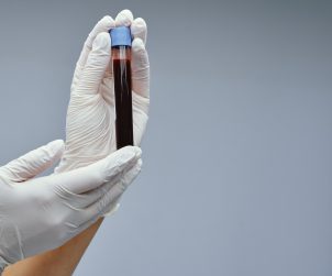 Pielęgniarka trzyma w dłoniach odzianych w białe, sterylne rękawiczki, fiolkę wypełnioną krwią pacjenta. /Źródło: 123rf.com