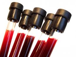 tczew badania krwi