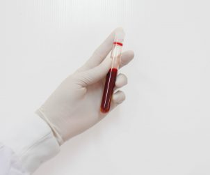 Pielęgniarka ubrana w sterylny strój trzyma w dłoni probówkę wypełnioną próbką krwi. /Źródło: 123rf.com