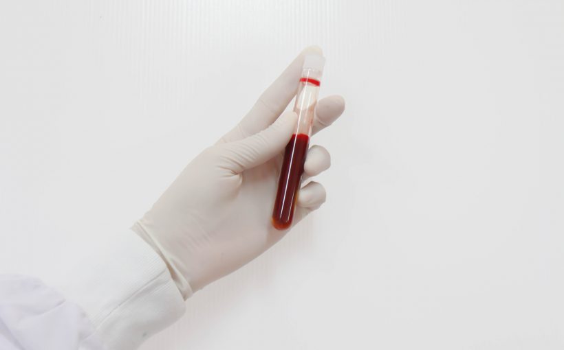 Pielęgniarka ubrana w sterylny strój trzyma w dłoni probówkę wypełnioną próbką krwi. /Źródło: 123rf.com